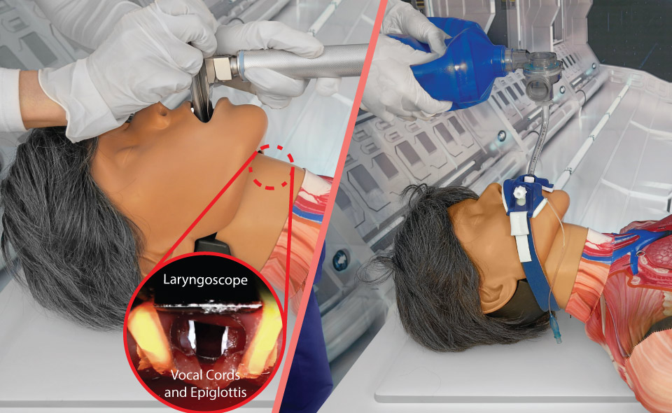 Emergency Resuscitation Simulation Systems